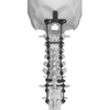 Spine posterior fixation system- Ceres 3.5
