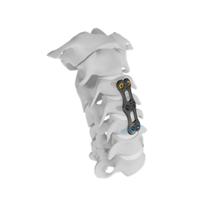 Camic Cervical Plate Systems-Anterior Cervical plate