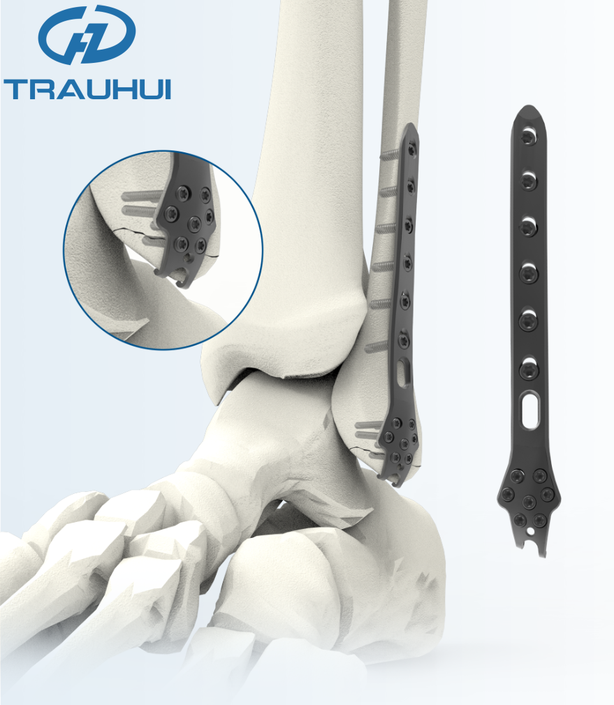 Distal Lateral Fibular Hook Plate3.png