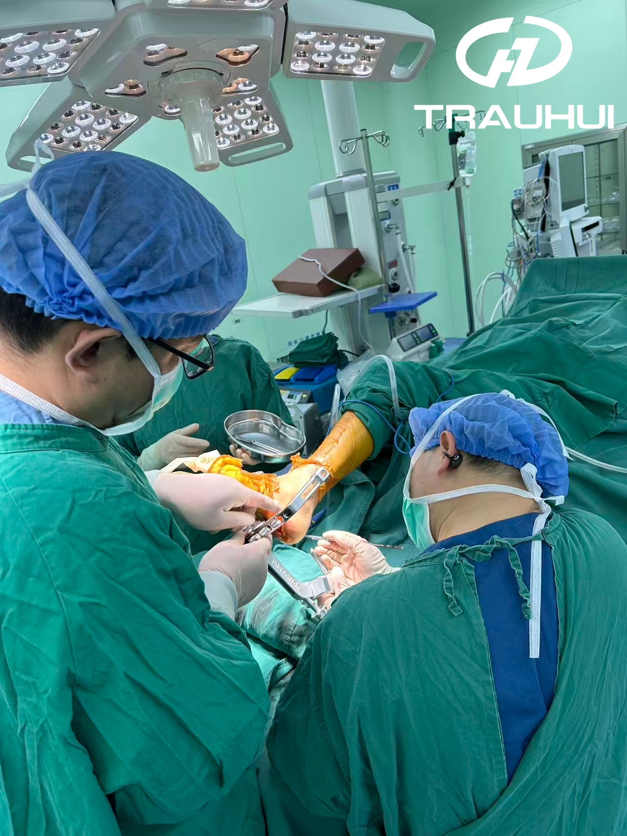 ankle fusion nail 3.jpg