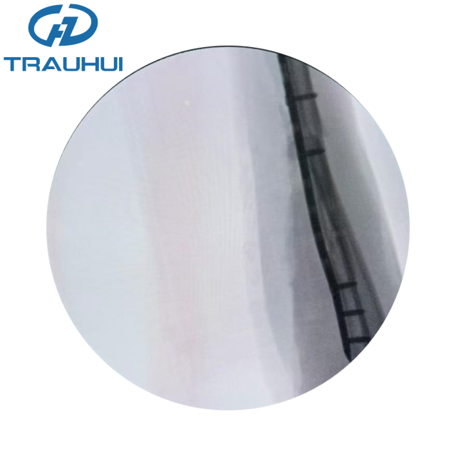 Distal Radius Volar Plates X ray 1.png