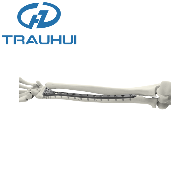 Distal Radius Volar Plates Long.png
