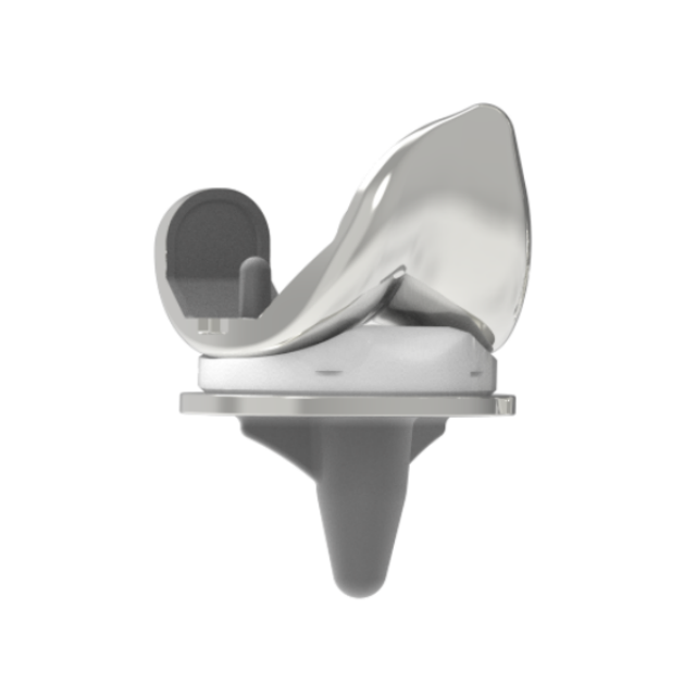 Transnity Cemented Knee Arthroplasty