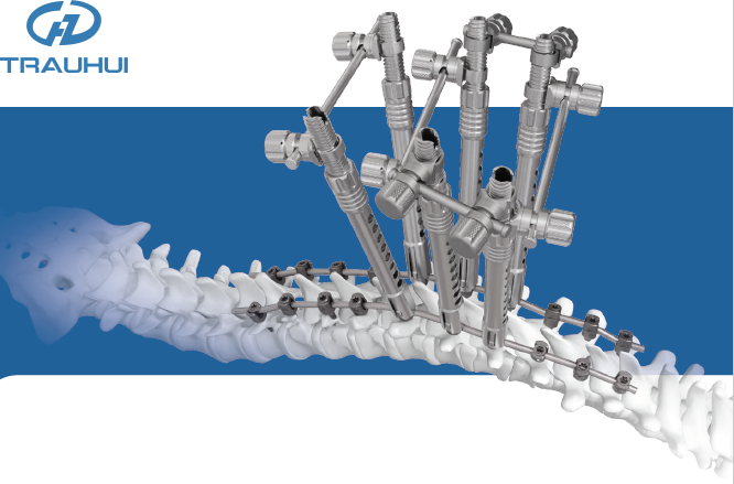 CSS5.5 Spinal Posterior Approach Correction.png