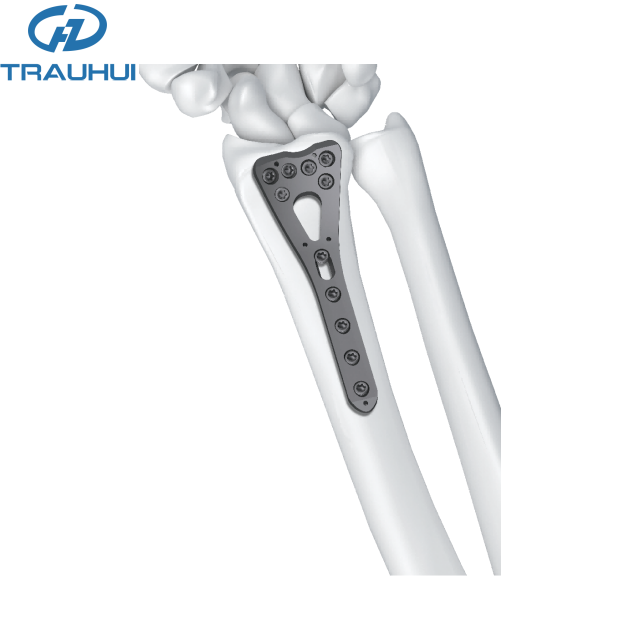 2.4 Distal Radius Volar Plates 8 holes head.png